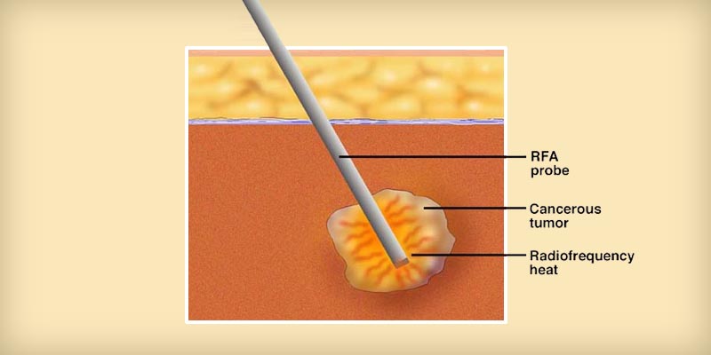 Ιατρείο Επεμβατικής Ακτινολογίας